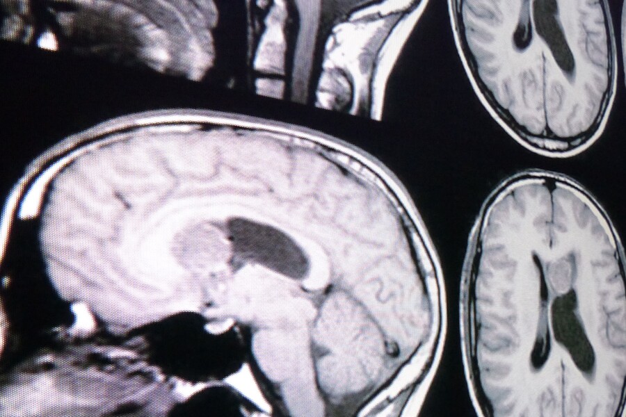 Image of Neuro Imaging
