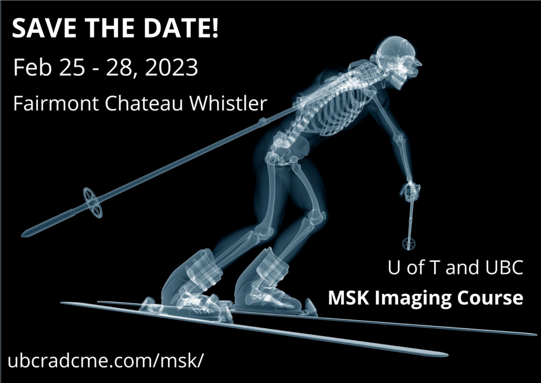 MSK Whistler Flyer